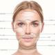 PDO Thread Face Lifts | PDO Thread Body Lifts | Cosmetics in Cape